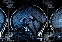 Brain Scan