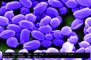 Anthrax spores