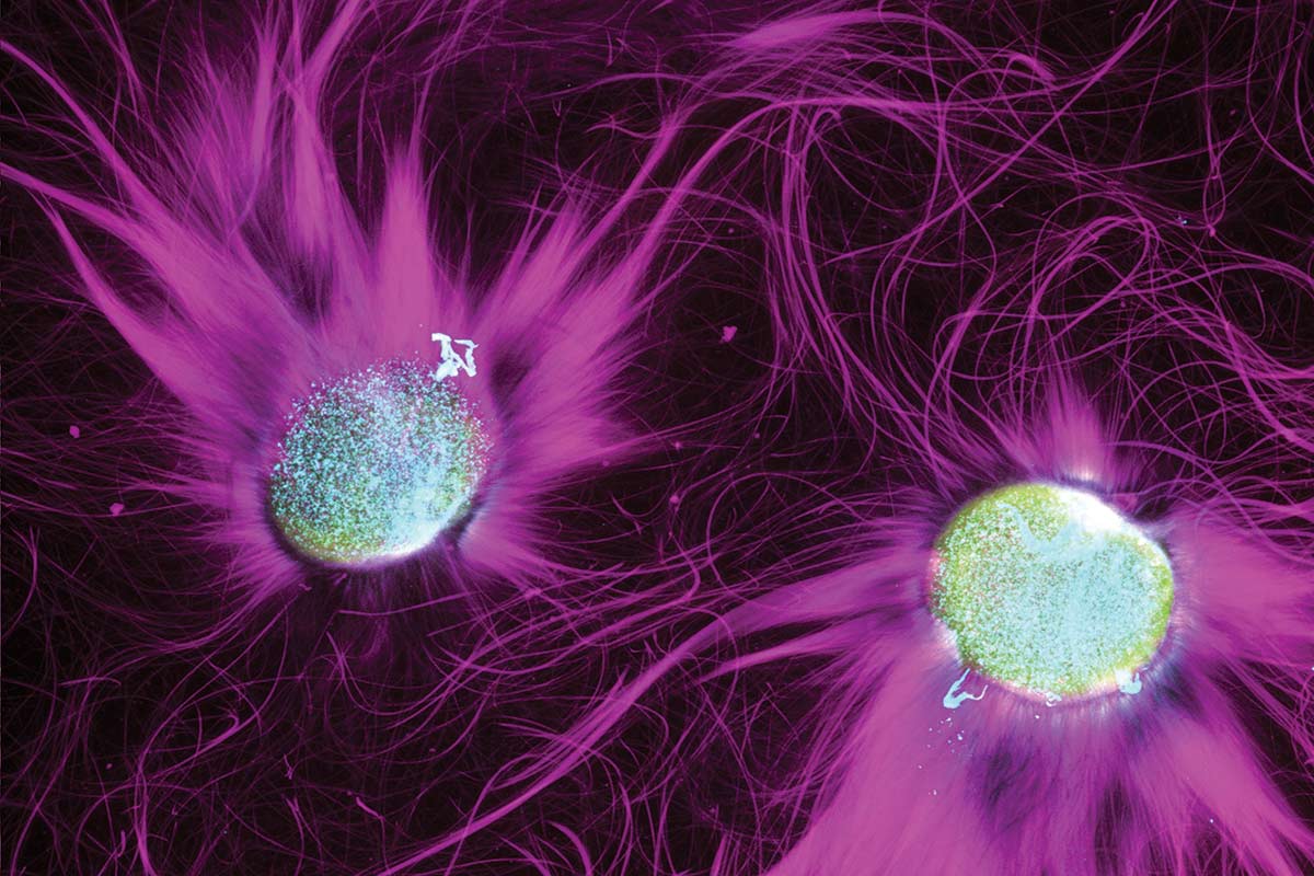 An image of filaments, with striking purple coloring.