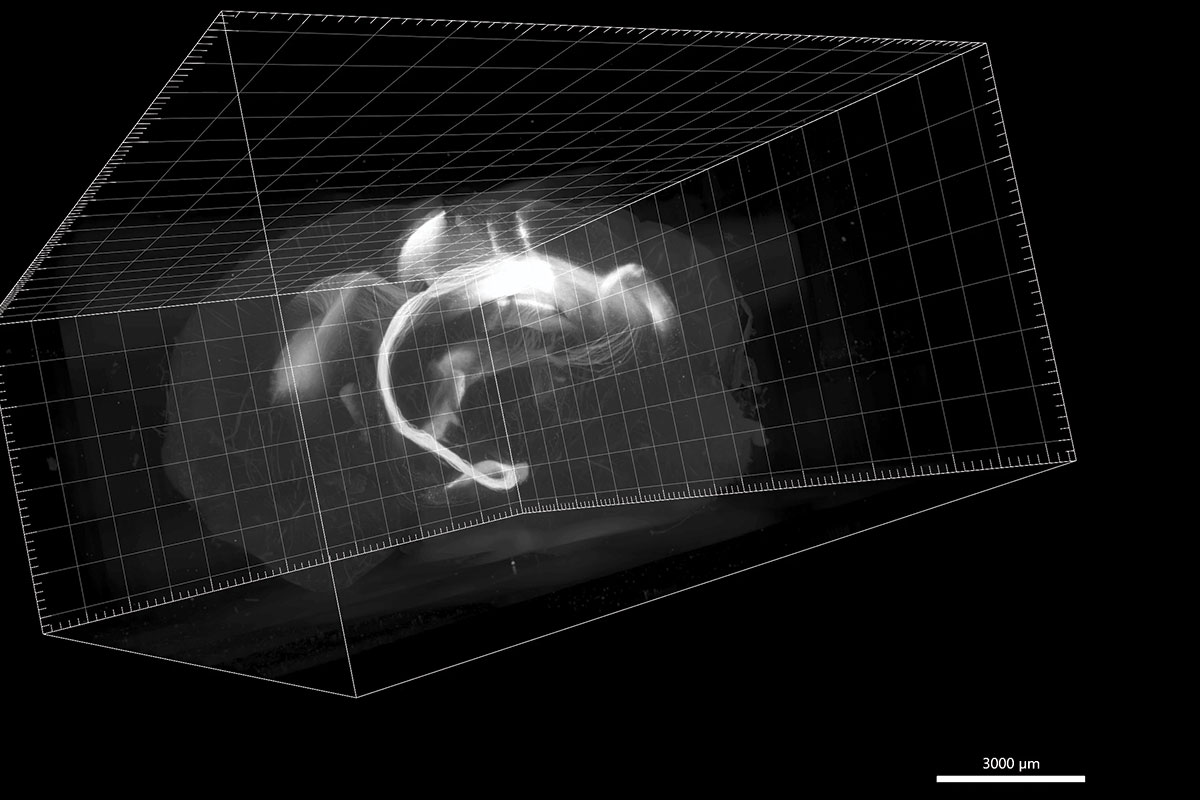 A black and white light sheet microscope image of a mouse brain.