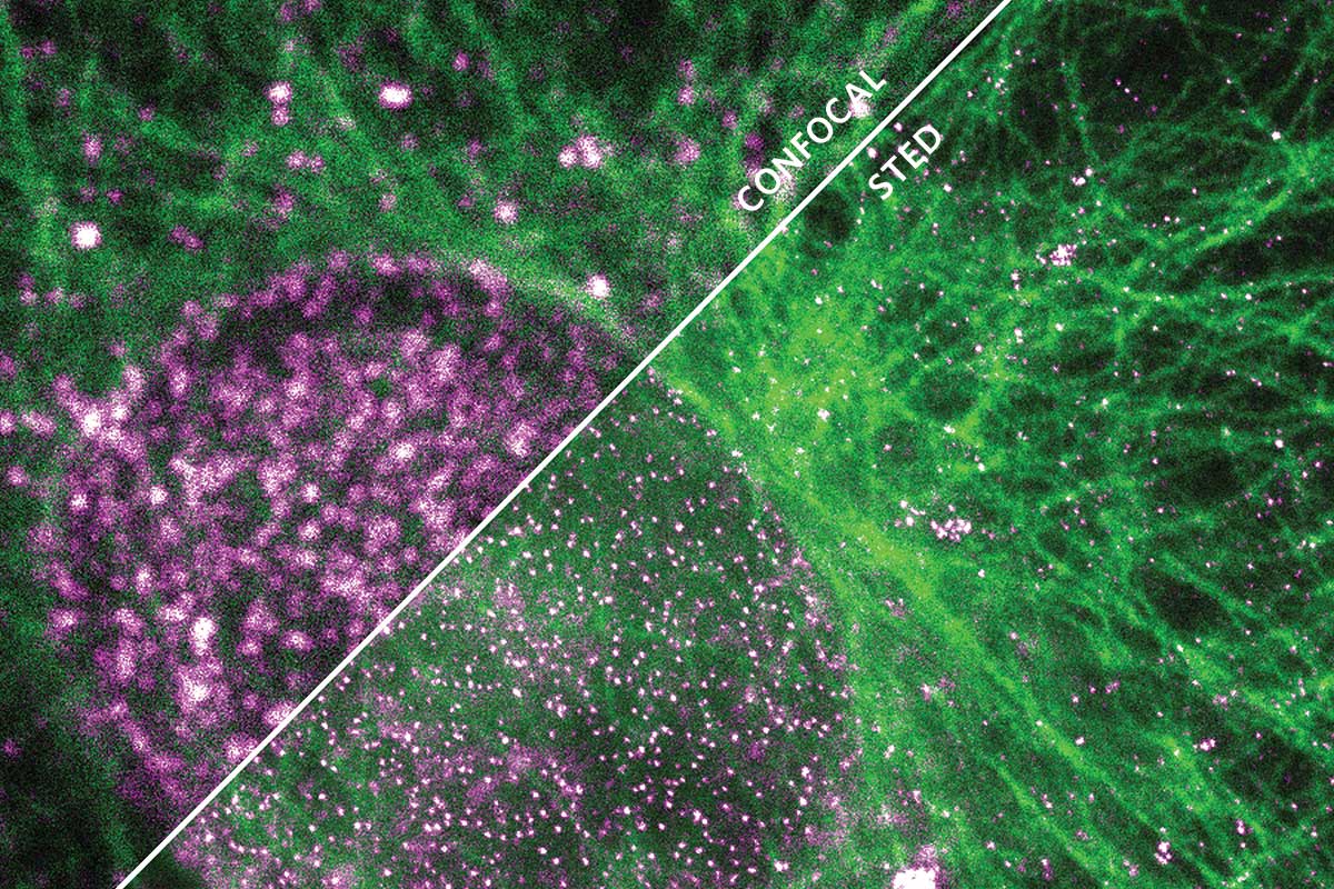 An image of filaments, with bright purple and green coloring. The top image is from a confocal microscope and the bottom image is from a STED microscope.