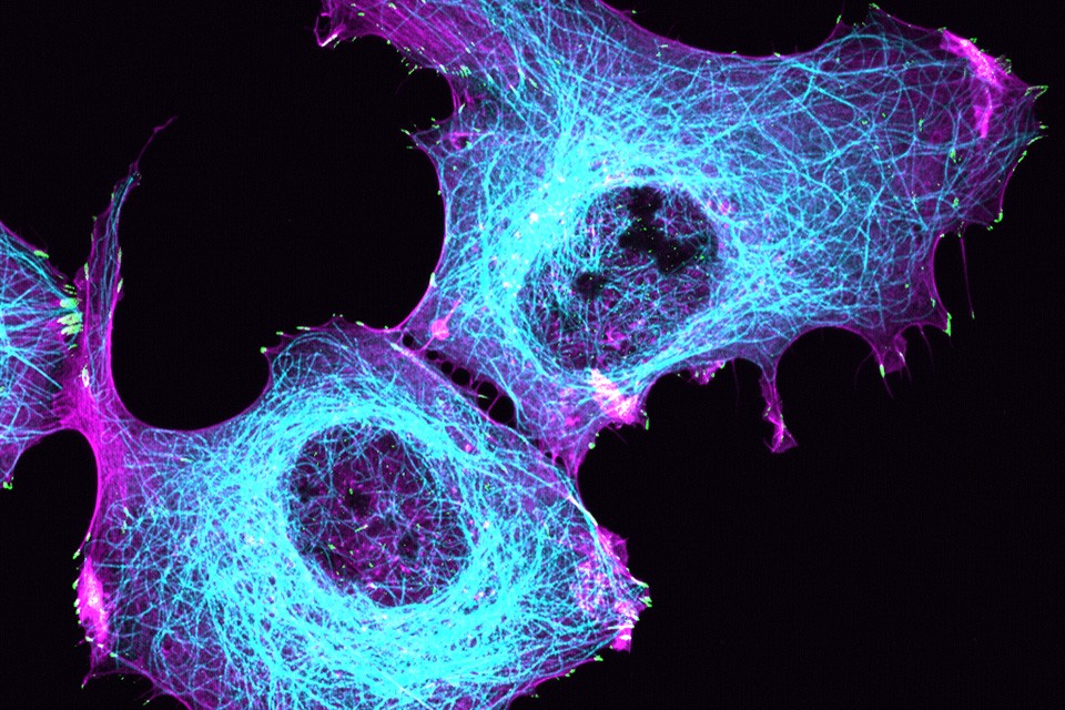 Confocal image of U2OS osteosarcoma cells fixed and stained with antibodies to Phospho-Paxillin to mark focal adhesions (green), antibodies to tubulin to mark microtubules (blue), and phalloidin to stain F-actin (pink).