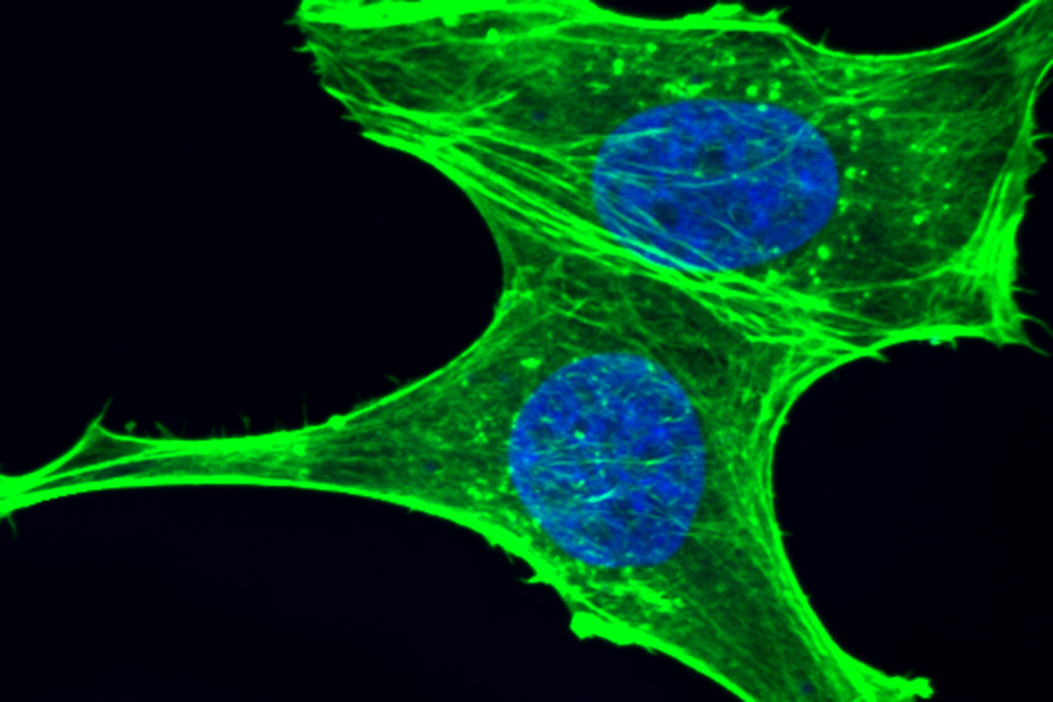 Confocal image of MDA-MD-231 breast cancer cells fixed and stained with phalloidin to mark F-actin (green) and DAPI to stain the nucleus (blue)