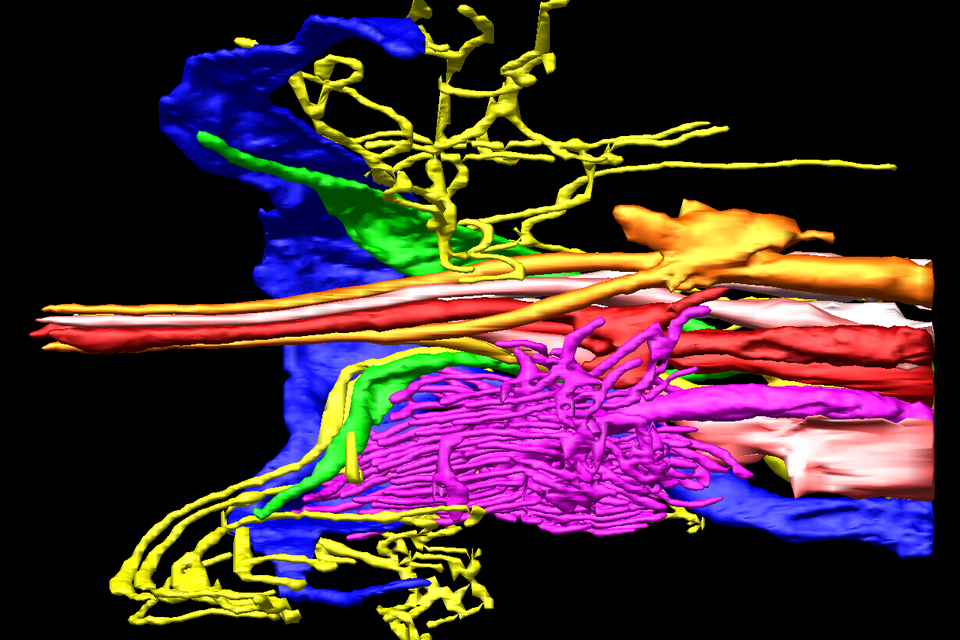 High-resolution ssTEM 3D reconstruction of the  amphid sensillum of C. elegans.