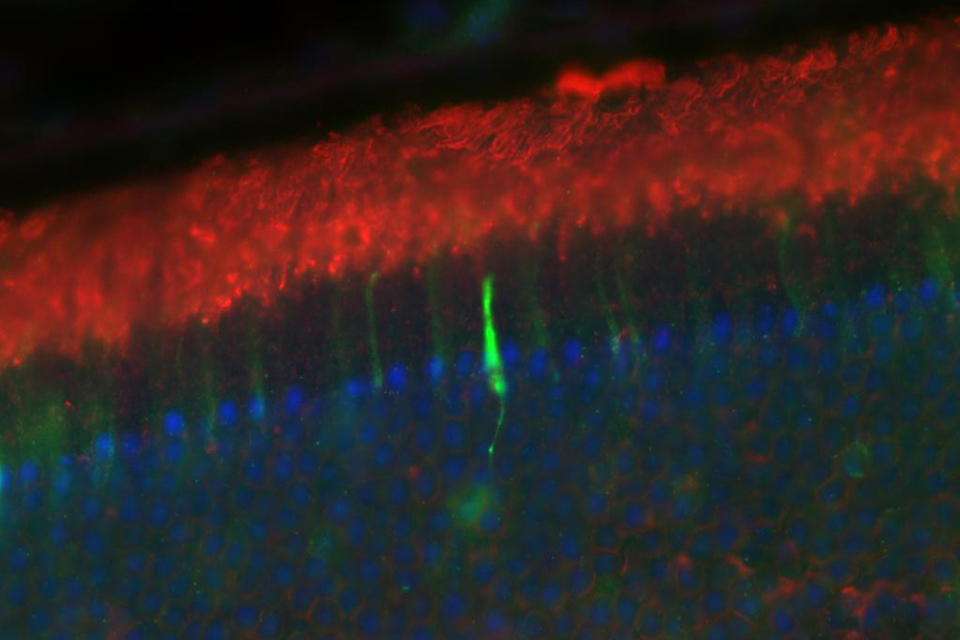 Mouse retina stained for DNA (blue), rhodopsin (red) and IMPDH-GFP (green)