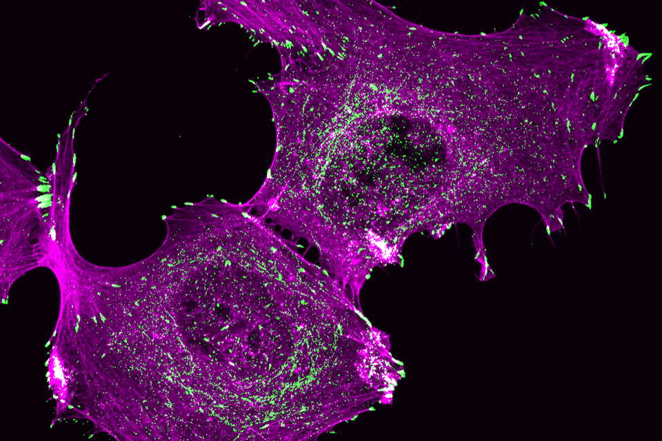 Confocal image of U2OS osteosarcoma cells fixed and stained with antibodies to Phospho-Paxillin to mark focal adhesions (green), and phalloidin to mark F-actin (pink)