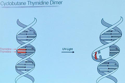 Poster entitled "Cyclobutane Thymidine Dimer".  Pictured below on the left is a double helix with 2 sections labeled "thymidine" with arrows to corresponding areas highlighted in red.  On the left is another double helix with a label "UV-Light" and an arrow pointing to an area that is falling apart,.