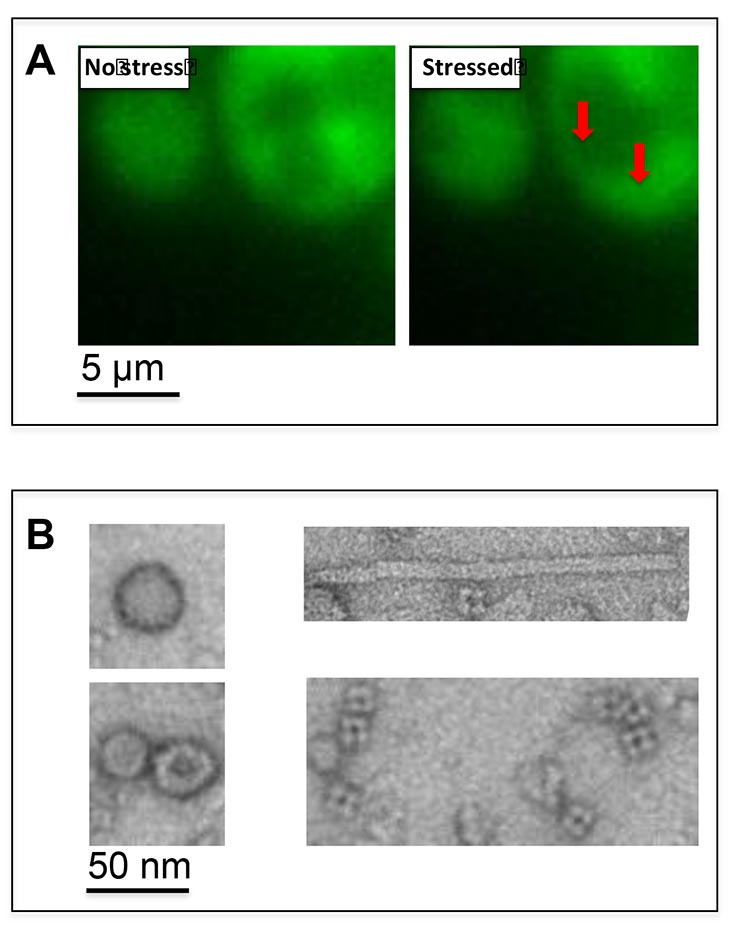 Two images showing the characterization of stress granule dynamics in cells using live cell imaging techniques in Figure A. The image on the left is labeled "No stress" and the image on the right is labeled "Stressed" and has 2 red arrows pointing downwards. At the bottom of Figure A it says: 5um. Figure B  shows electron microscopy micrographs of studies in vitro of the protein components that are integral to the assembly of stress granules.  Ther are 2 square shape images and 2 elongated rectangles, each containing 1 - 12 elliptical shapes. It is labeled 50nm.