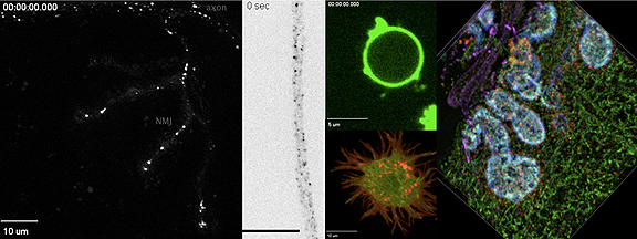 Fluorescence microscopy images of membrane trafficking and remodeling events in neurons, in cells in culture, and in purified systems.