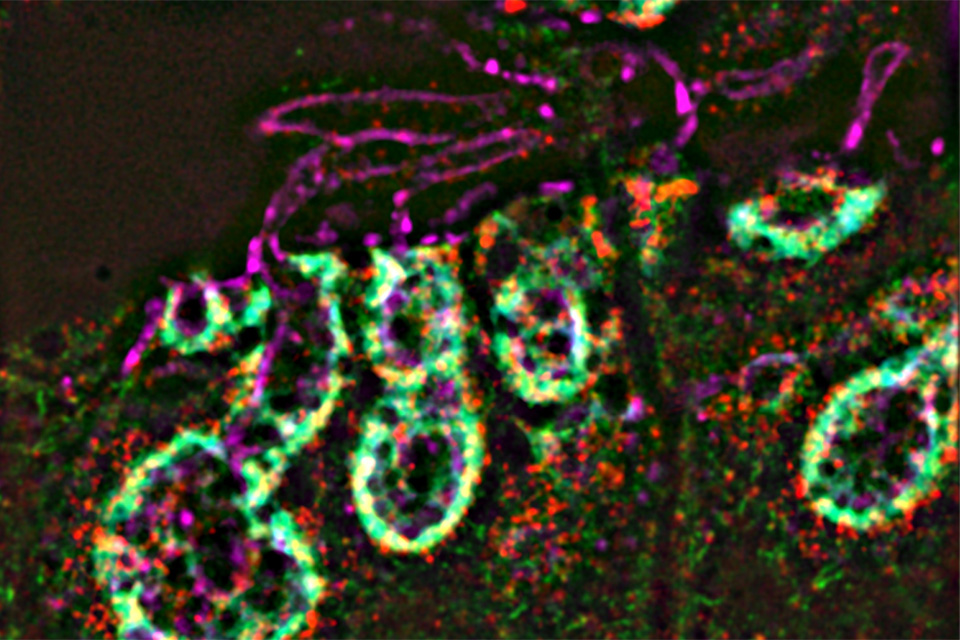 Research image from the Avital Rodal lab