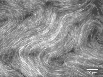 Active Matter