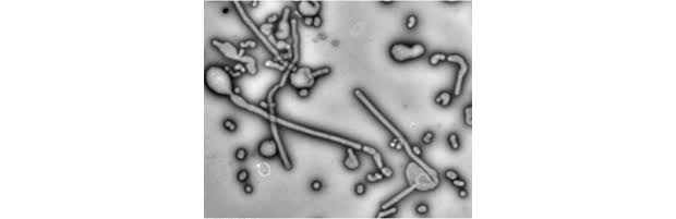 Long, string-like flu virus particles