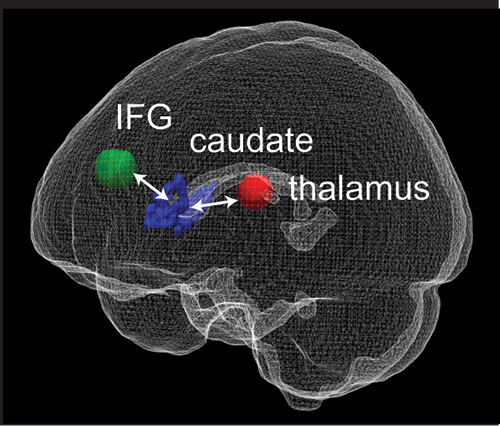 a picture of a brain with connections between the inferior frontal gyrus (a part of prefrontal cortex), caudate, and thalamus