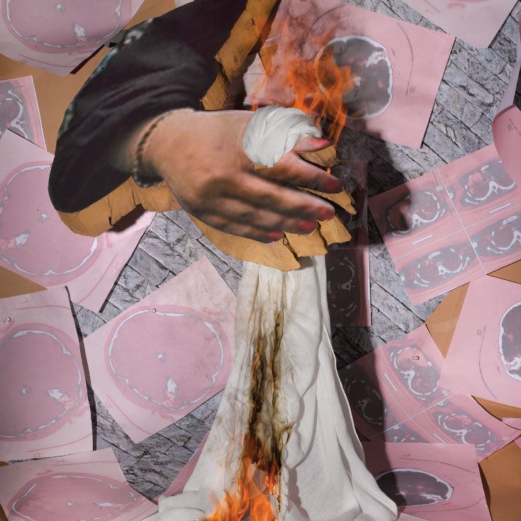 Mixed media collage with pink background and a hand wrapped in a white bandage on fire.