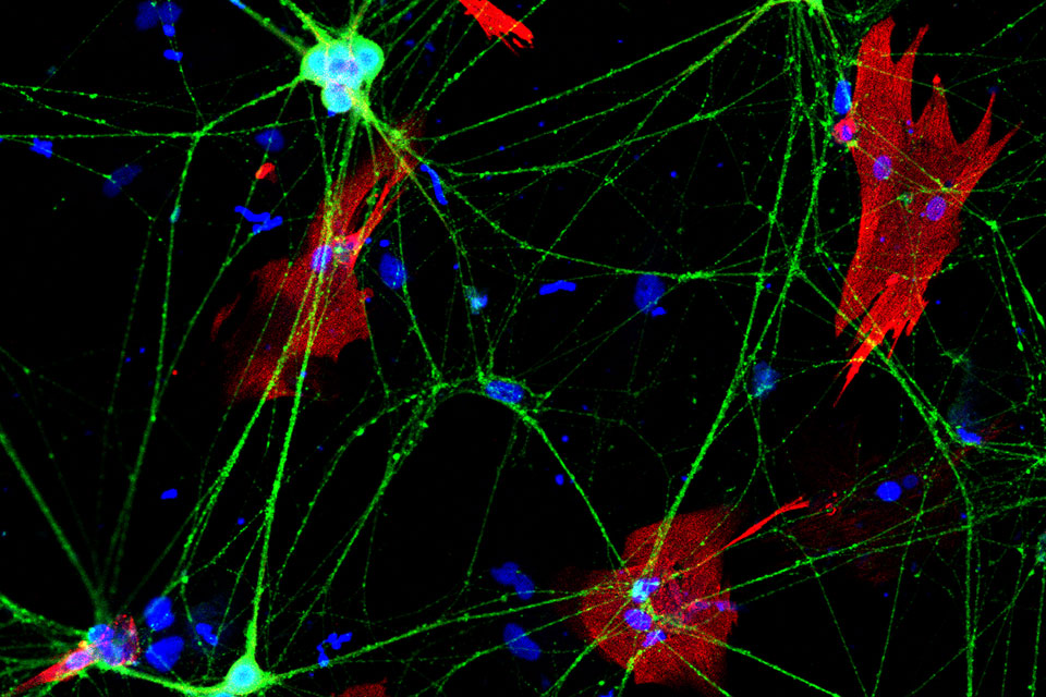 Colorful lights and patterns