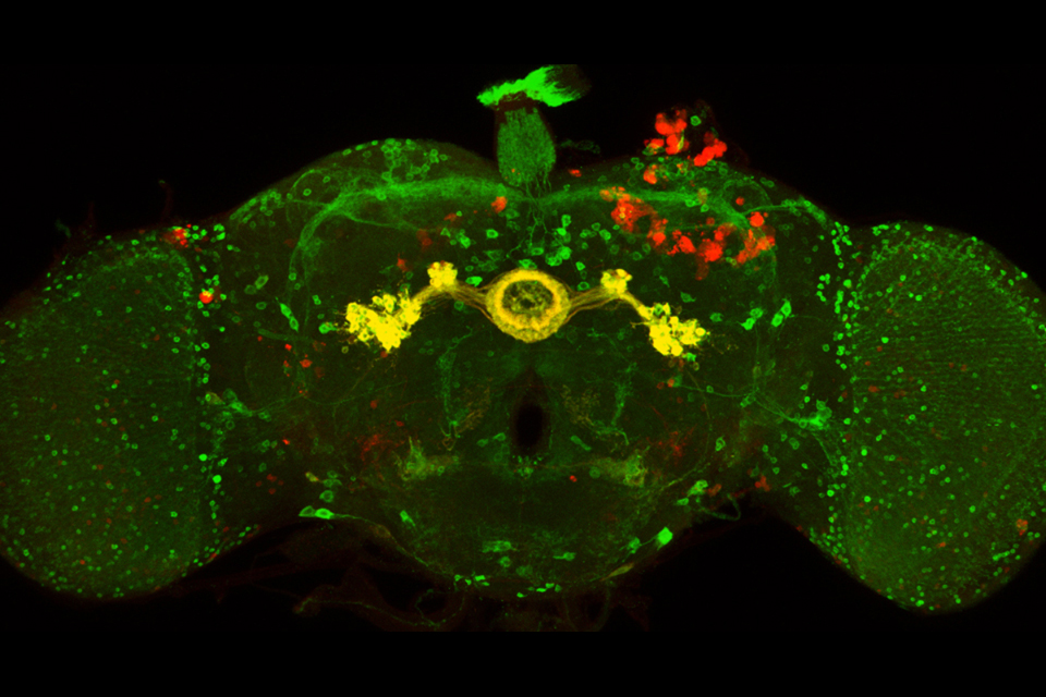 Brain image from Confocal Lab